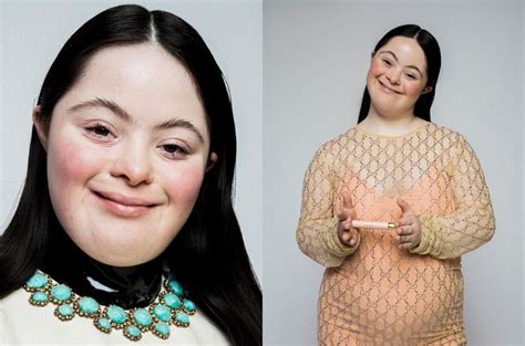 gucci trisomique|Gucci down syndrome.